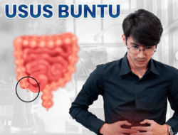 Yuk, Kenali Gejala Usus Buntu oleh Dokter Spesialis Bedah RSUD Pandega Pangandaran