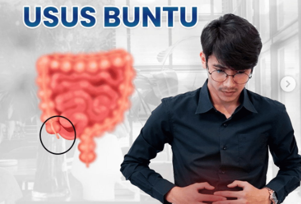 Yuk, Kenali Gejala Usus Buntu oleh Dokter Spesialis Bedah RSUD Pandega Pangandaran