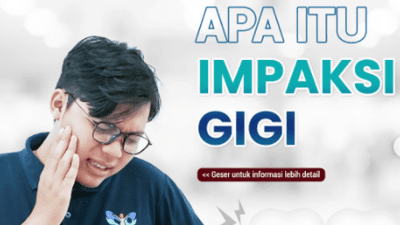 Apa Itu Impaksi Gigi, Simak Penjelasan Dokter Gigi Spesialis Bedah Mulut RSUD Pandega Pangandaran drg. Rani Septikasari