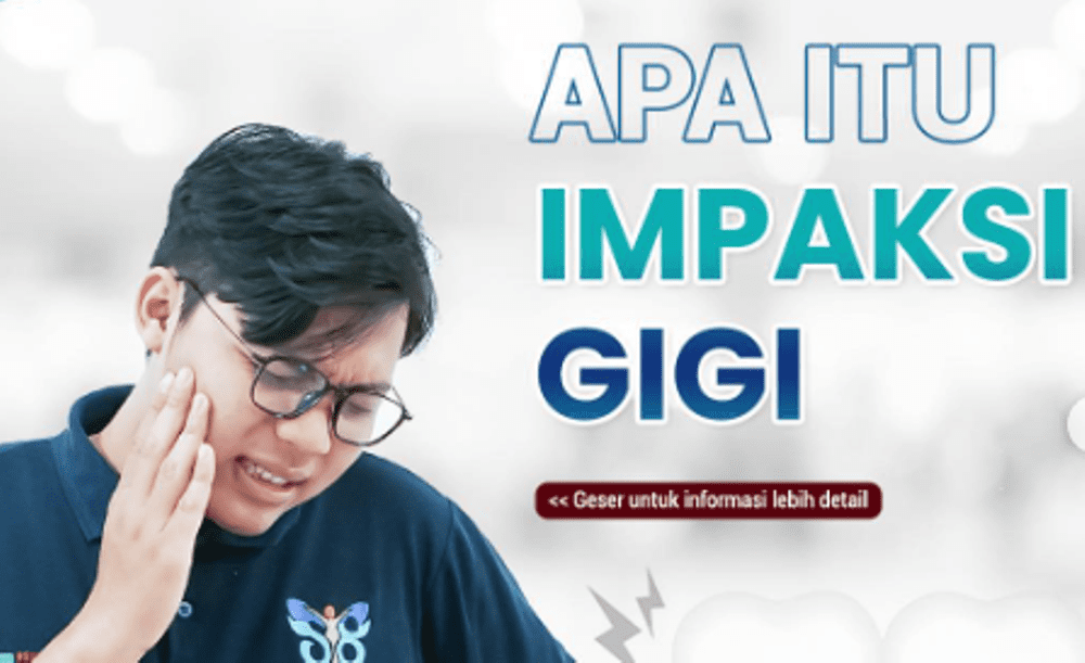 Apa Itu Impaksi Gigi, Simak Penjelasan Dokter Gigi Spesialis Bedah Mulut RSUD Pandega Pangandaran drg. Rani Septikasari