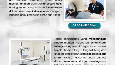 Simak Pelayanan Pemeriksaan Radiologi di RSUD Pandega Pangandaran
