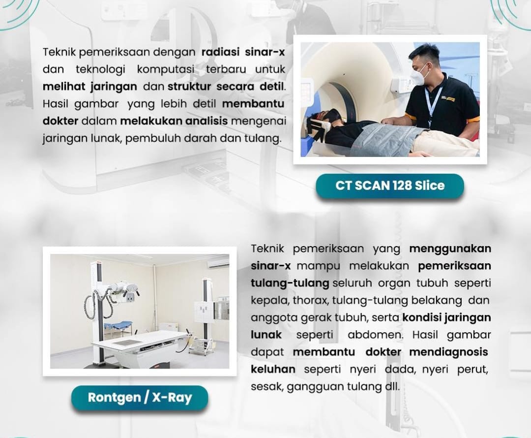 Simak Pelayanan Pemeriksaan Radiologi di RSUD Pandega Pangandaran