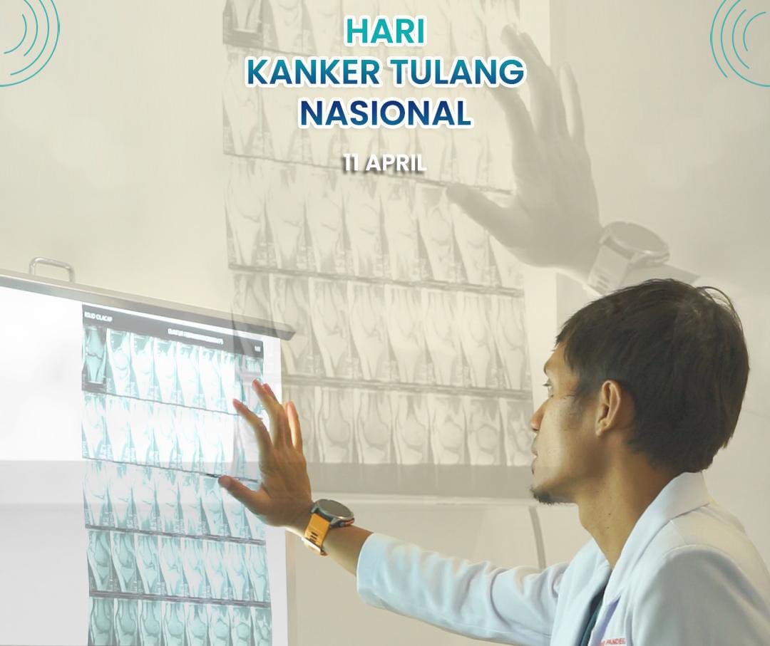 Hari Kanker Tulang Nasional: Peringatan Penting untuk Tingkatkan Kesadaran dan Deteksi Dini