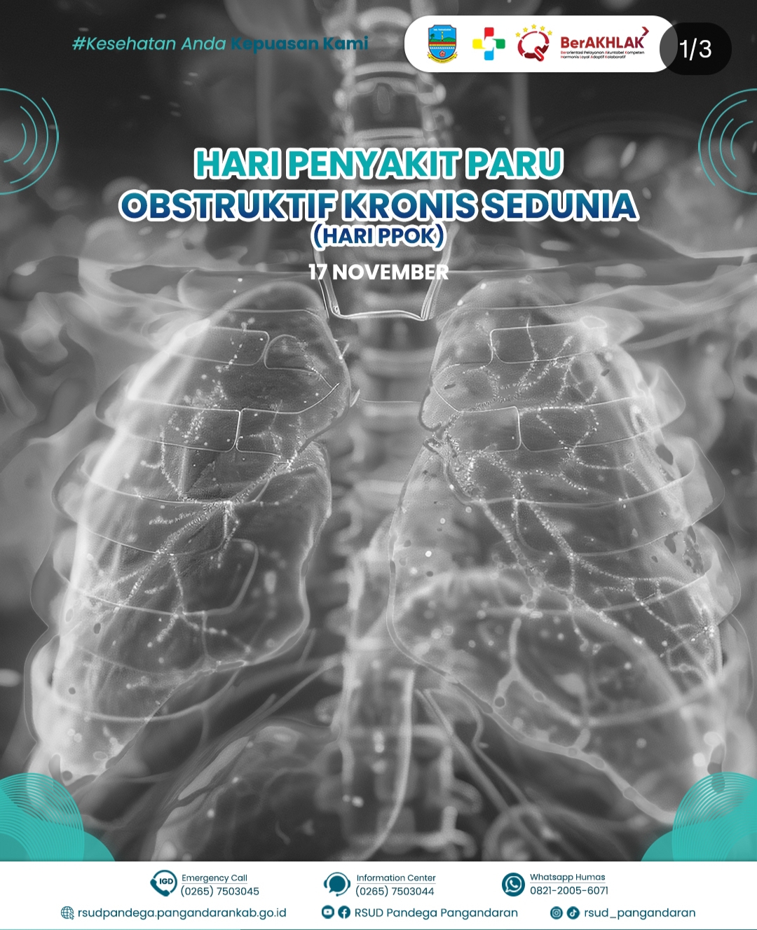 RSUD Pandega Pangandaran Peringati Hari Penyakit Obstruktif Kronis