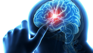 Layanan Pemeriksaan Dokter Spesialis Saraf RSUD Pandega Pangandaran