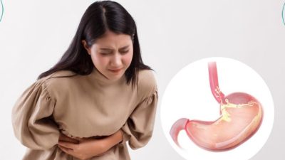 RSUD Pandega Pangandaran Ingatkan Bahaya Asam Lambung Saat Puasa, Hindari “Balas Dendam” Saat Berbuka