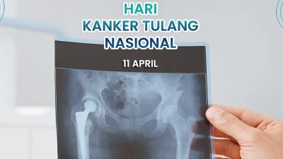 Hari Kanker Tulang Nasional: RSUD Pandega Pangandaran Tekankan Pentingnya Deteksi Dini
