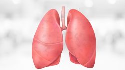 RSUD Pandega Pangandaran Perkuat Deteksi Dini dan Edukasi Publik, Putus Rantai Penularan Tuberkulosis