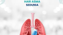 Menata Napas di Hari Asma Sedunia: Ikhtiar RSUD Pandega Melawan Sesak