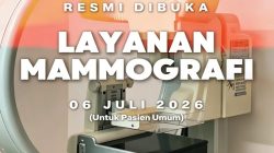 RSUD Pandega Resmi Buka Layanan Mamografi untuk Deteksi Dini Kanker Payudara
